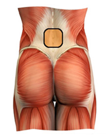 Injury Expert - lower back pain