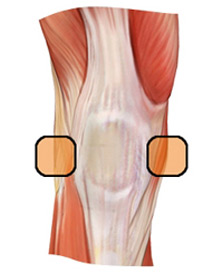 Injury Expert - Knee Pain