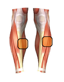 Injury Expert - Shin Splints